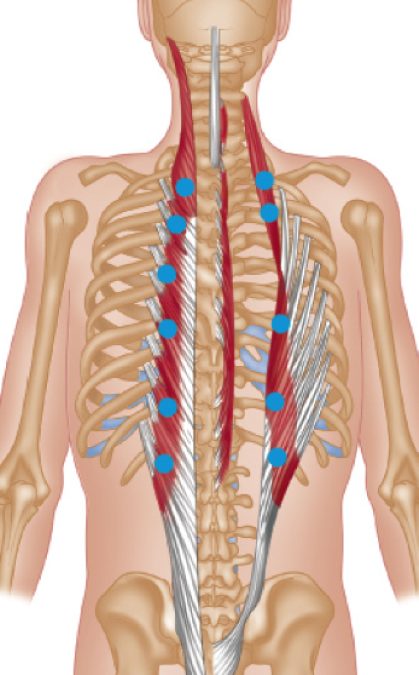 Lower Back Trigger Points