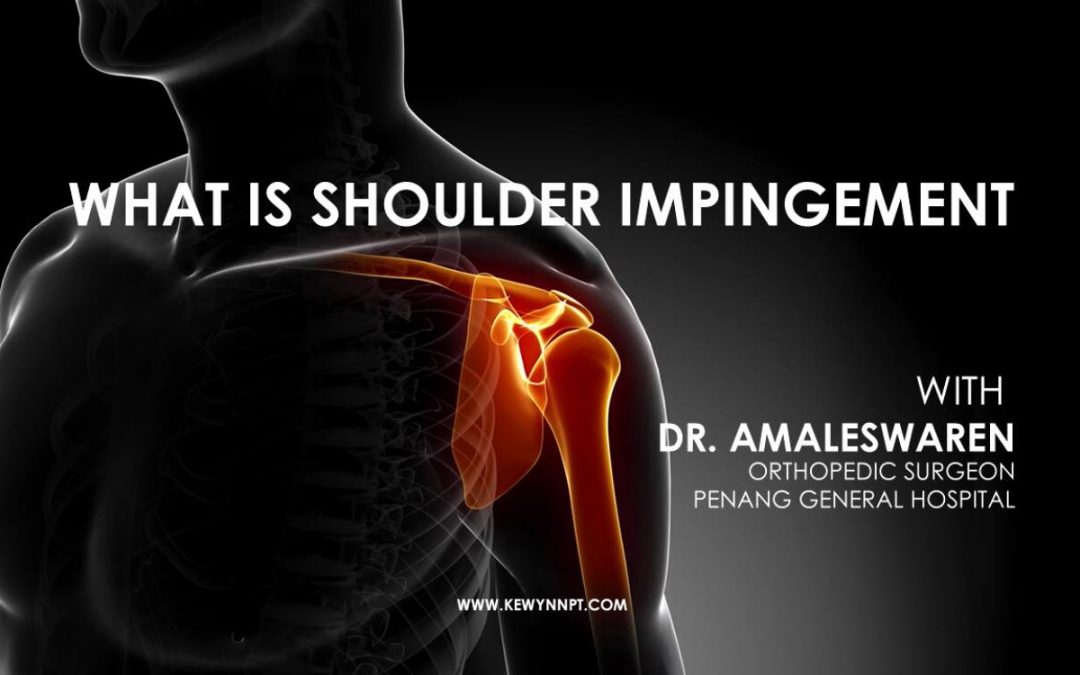 What is Shoulder Impingement? (Video)